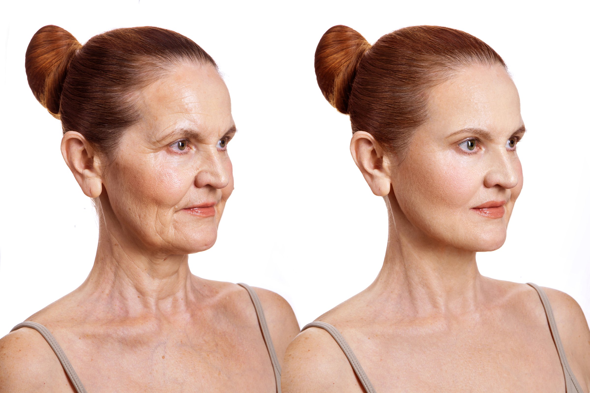 Portrait of a woman after 60 years old before and after lifting, application of creams and other cosmetic procedures for mature skin care. Close-up, on a white background.