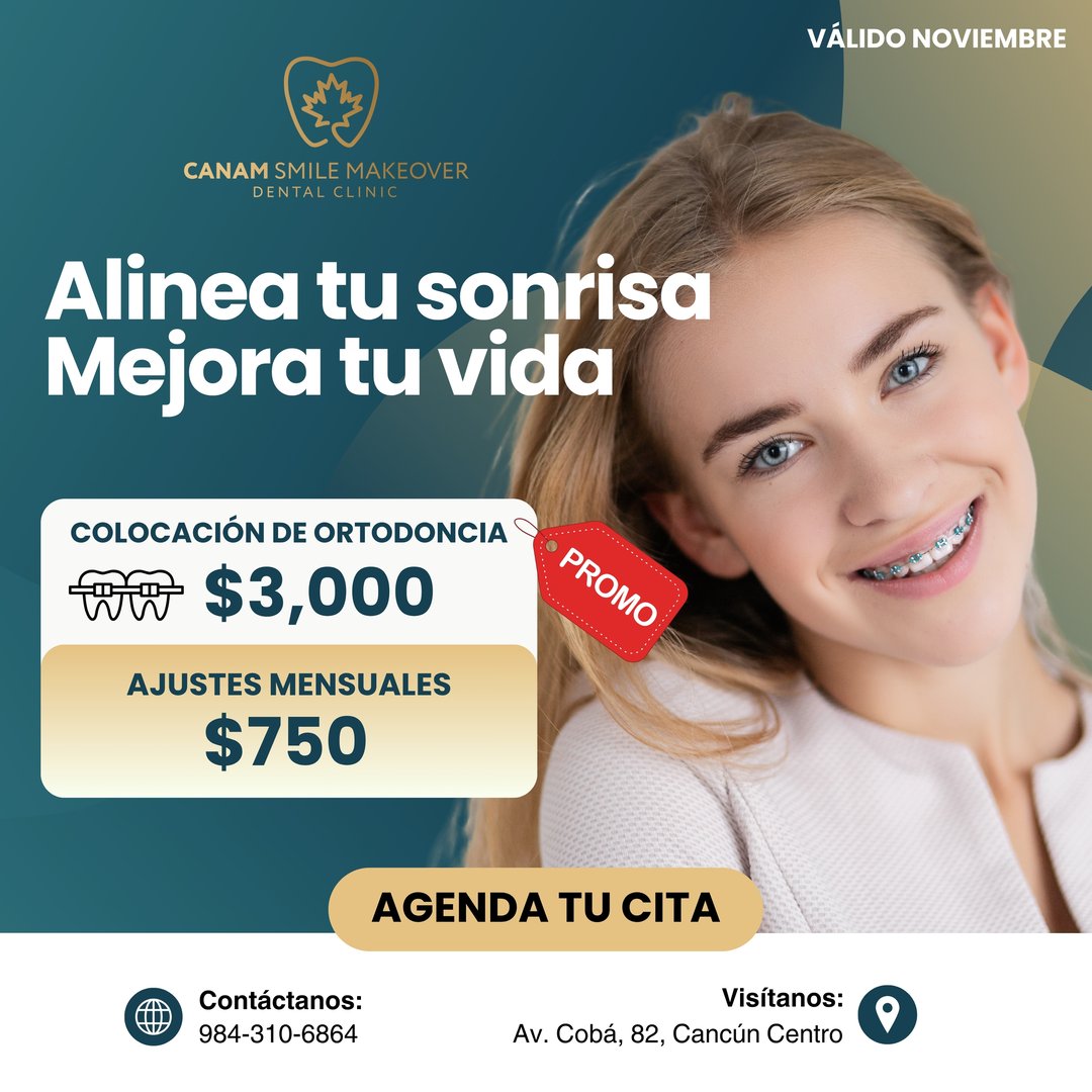 Promoción de Ortodoncia en Canam Smile Makeover