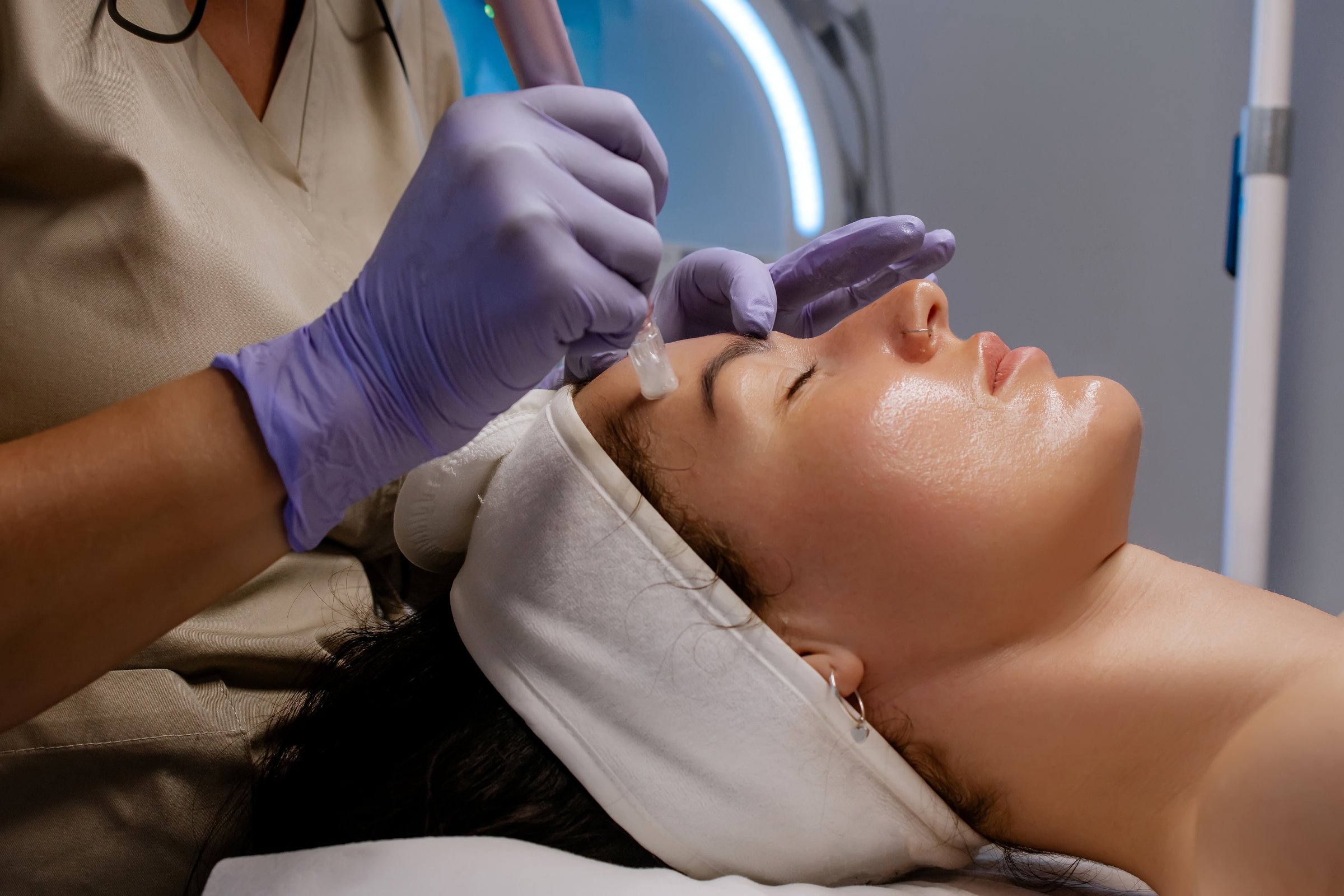 Woman receiving a professional microneedling treatment at a cosmetology clinic. A beautician in gloves is using a dermapen device on the client's face for skin rejuvenation and collagen stimulation