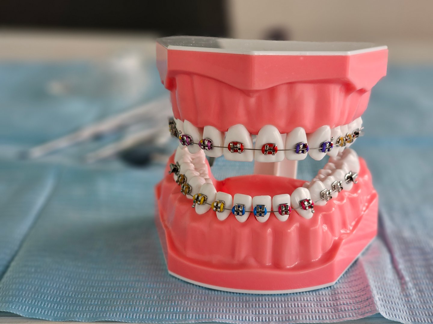 Educational dental model showcasing orthodontic braces
