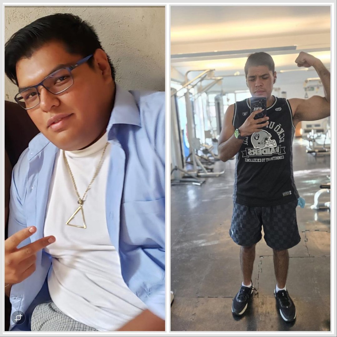 Antes y después - Pérdida de peso