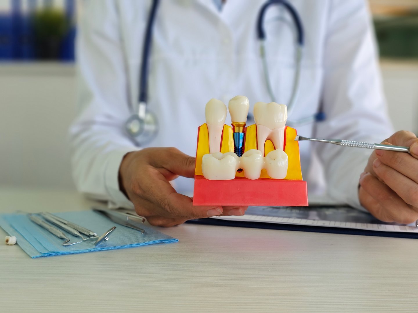 Doctor showing educational model of dental implant in clinic, closeup