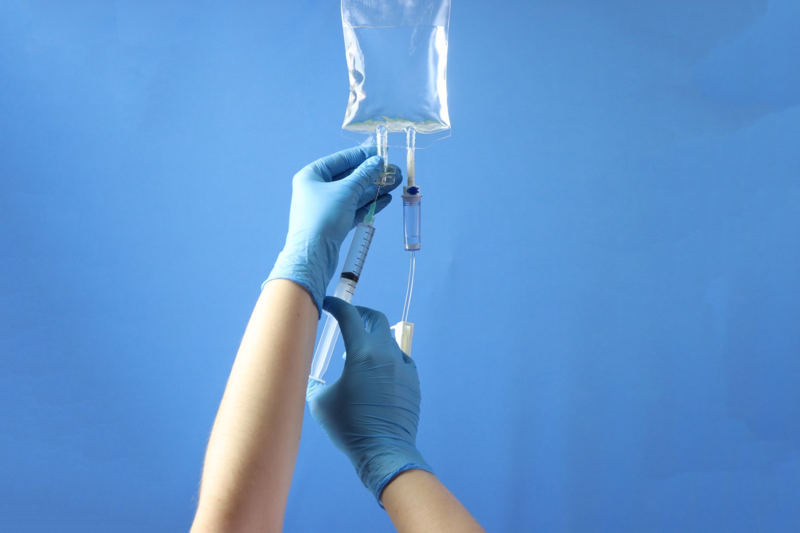 Drug bag with a infusion set connected to delivery the drug to the pacient. Professional holding the bag to infuse the drug with a syringe