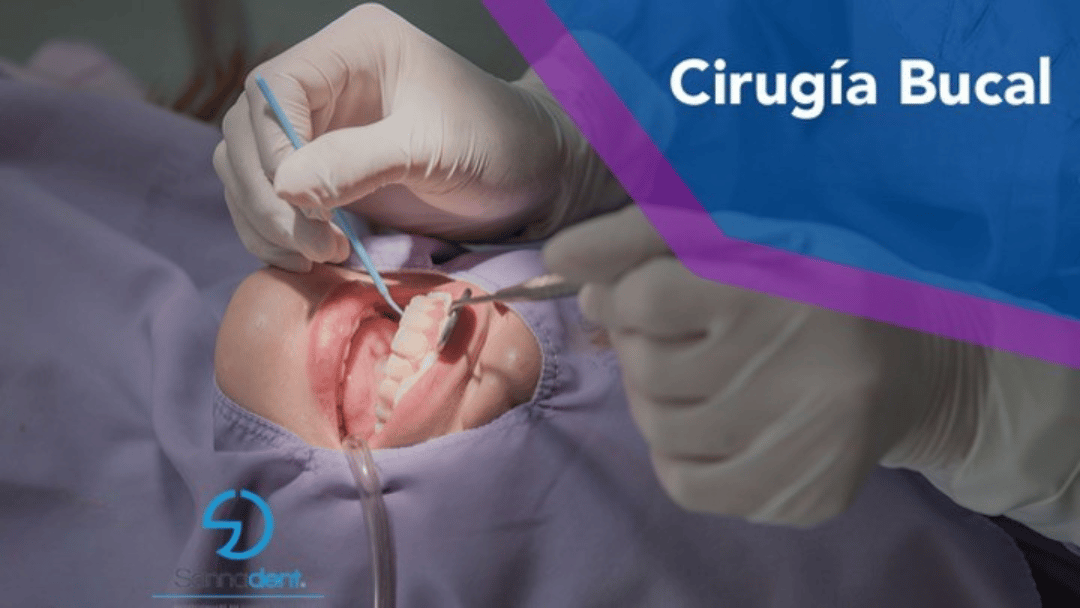 Sannadent - Cirugía Bucal