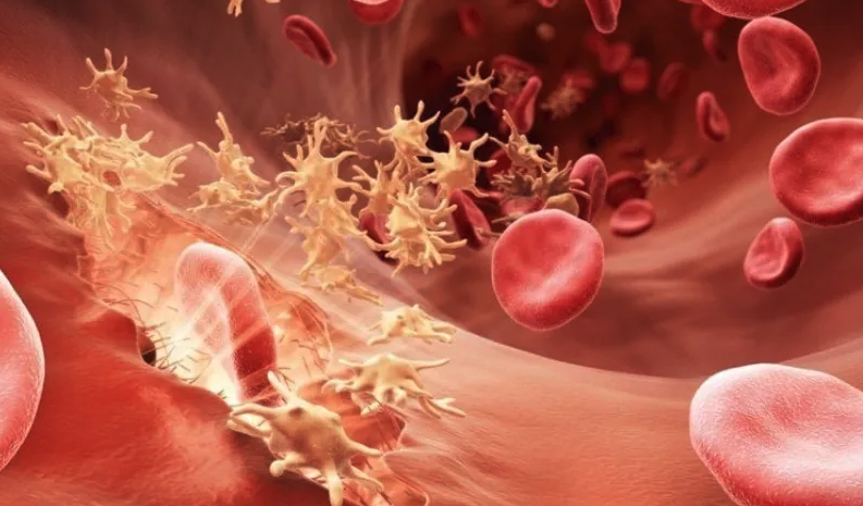 Nguyên nhân bệnh lý nước tiểu màu đỏ