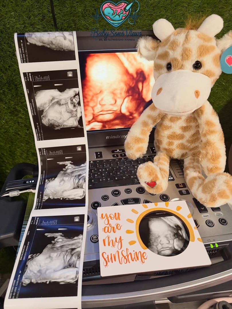 Baby ultrasound portrait