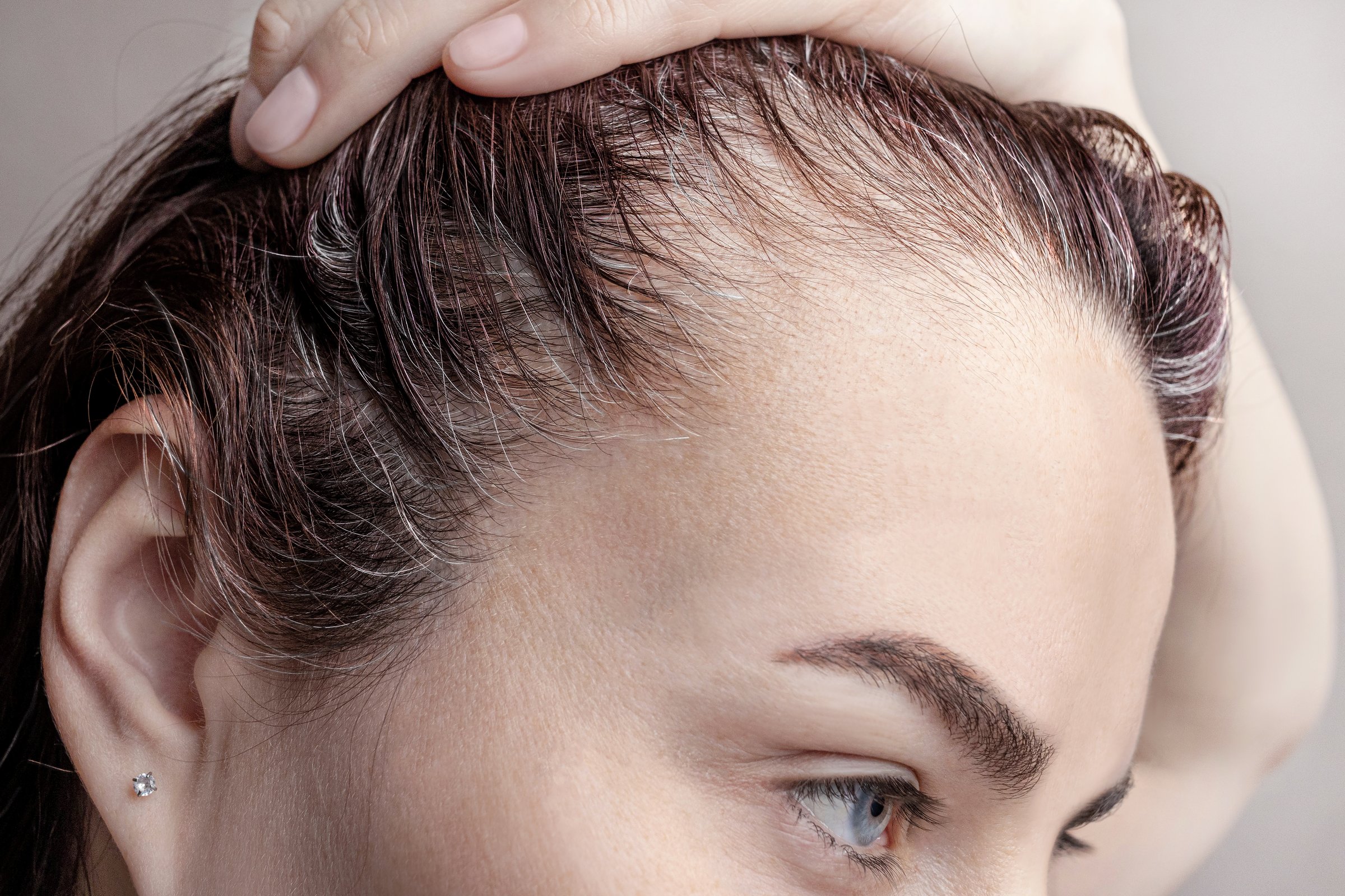 Woman with gray hair and thinning crown in Bradenton FL - female SMP coverage for gray hair clients at CC Styling Studio
