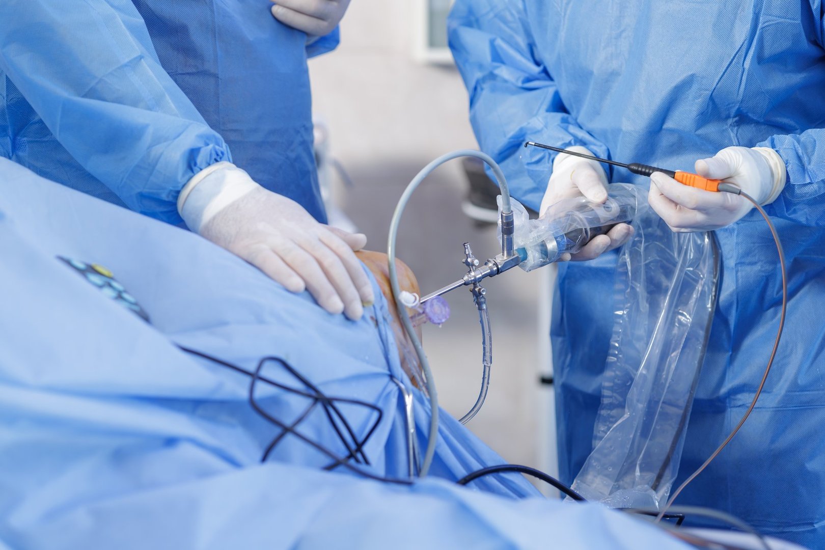 Surgeons perform knee arthroscopy with PCL reconstruction using arthroscope and probe on blue sterile drapes minimally invasive orthopedic surgery