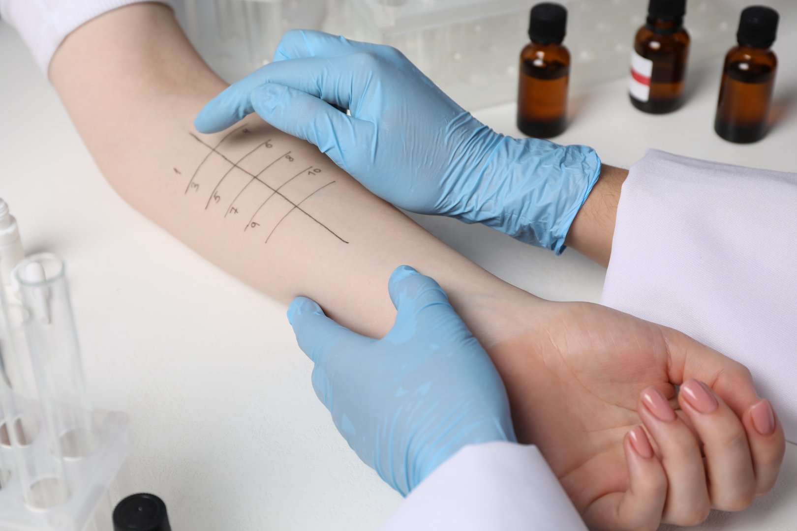 Doctor doing skin allergy test at light table, closeup