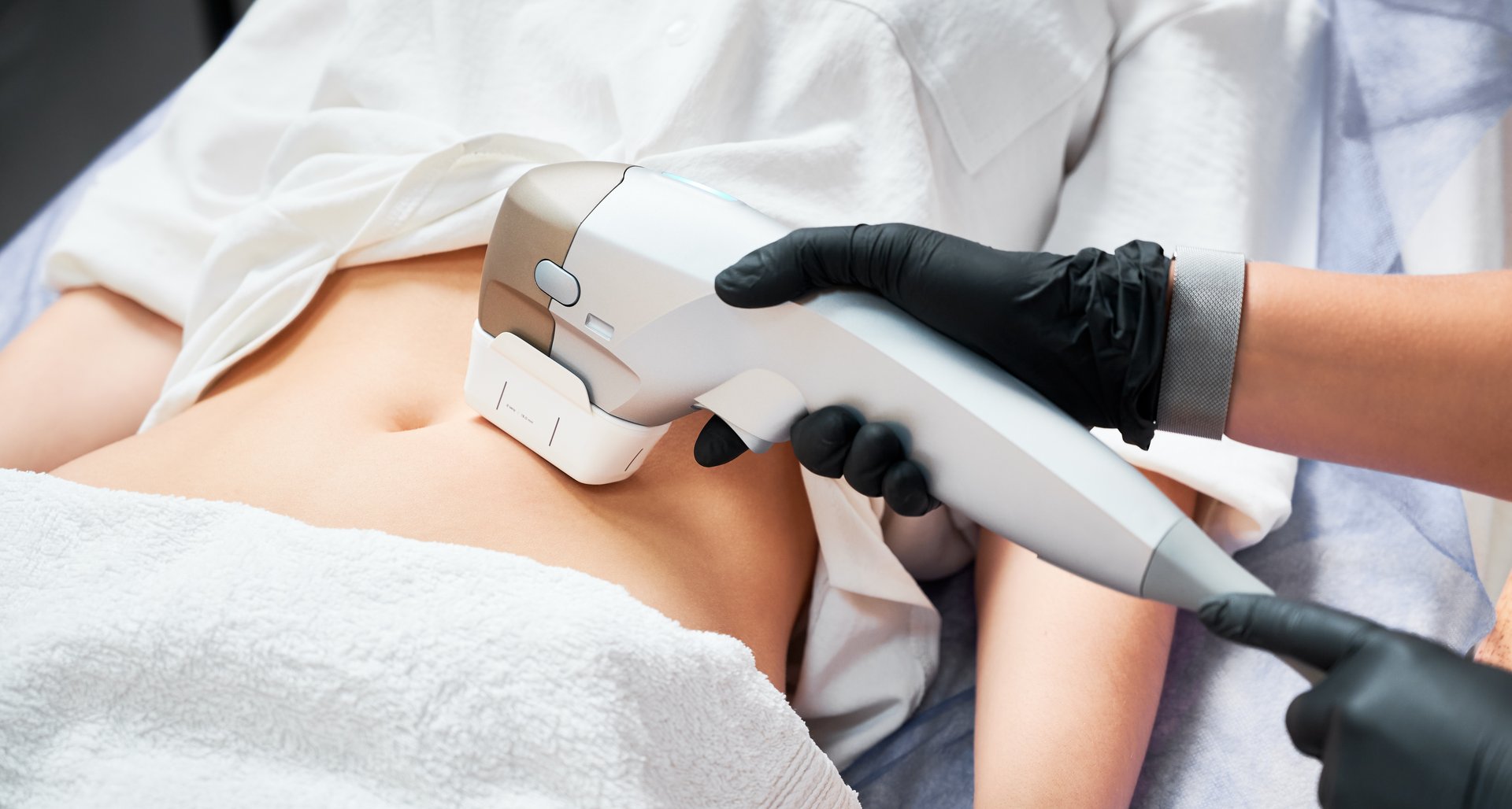 Procedimiento de depilación láser con máquina Candela en un consultorio profesional de dermatología estética