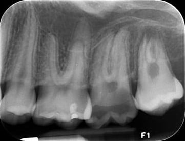 Descripción de imagen