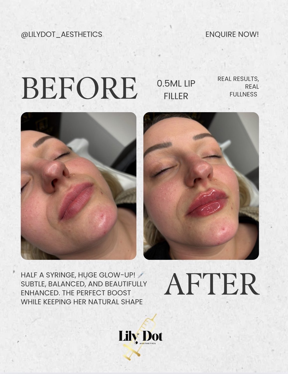 Precision facial aesthetic work