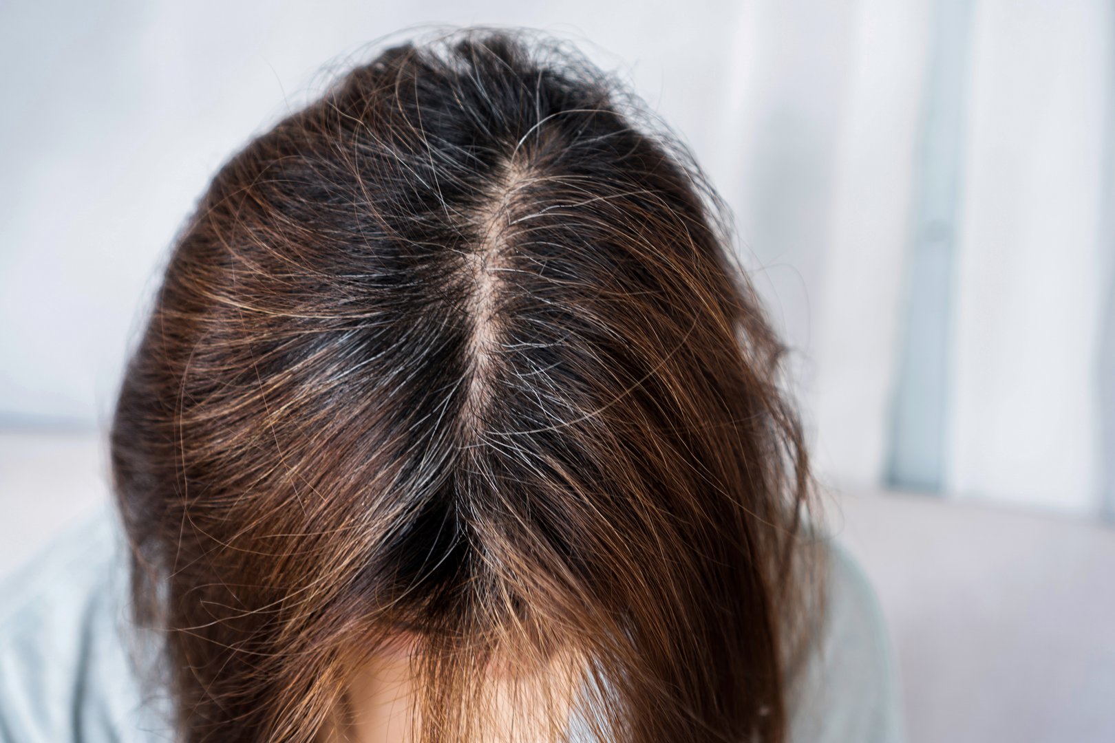 Close-up woman experiencing thinning hair and hair loss due to chemical or dye damage, leading to increased grey hair growth