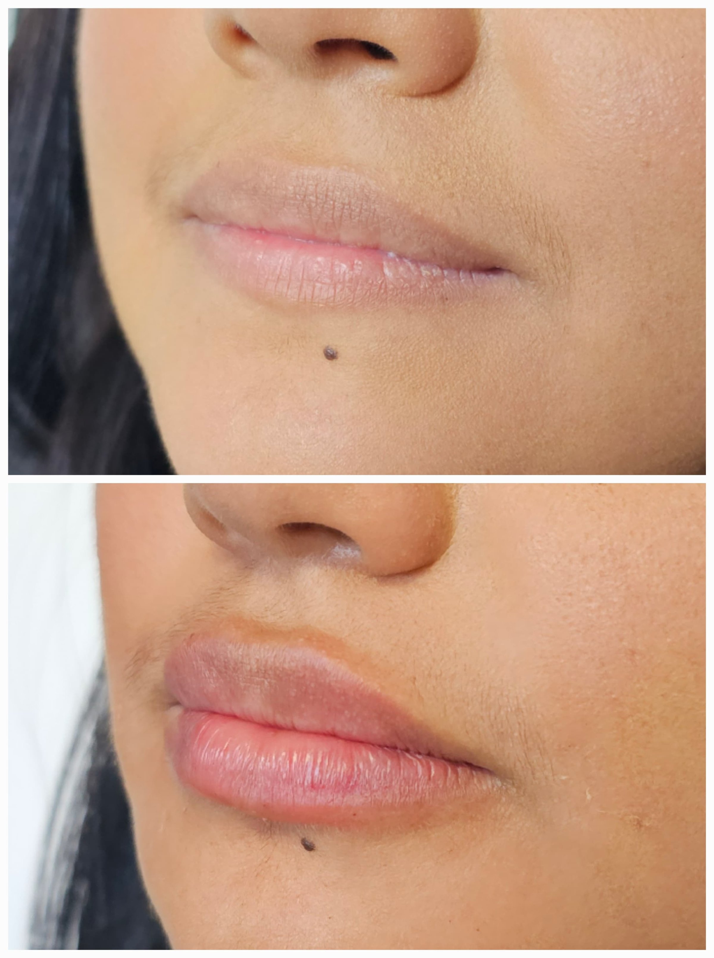 Resultado del tratamiento