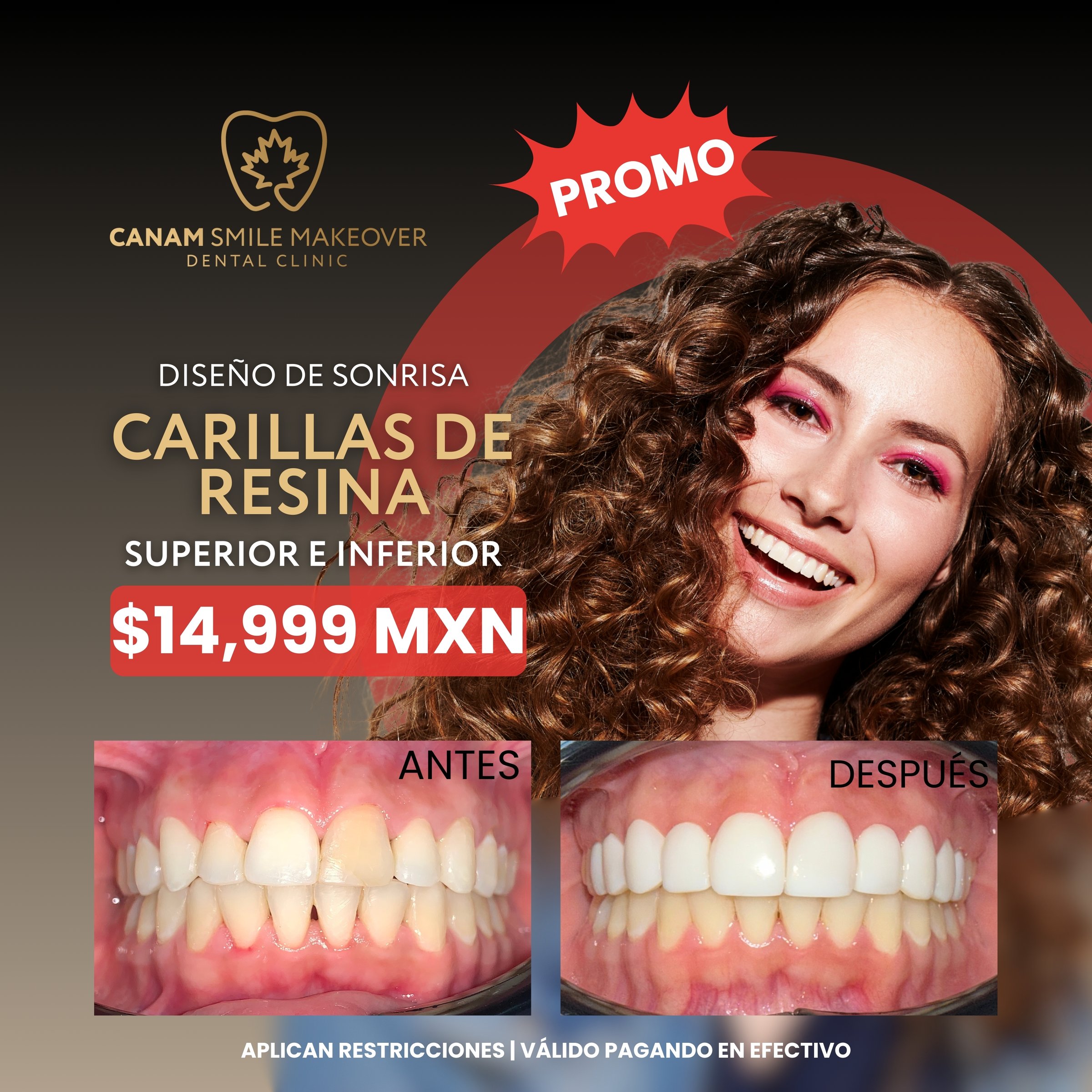 Promoción dental Canam Smile Makeover
