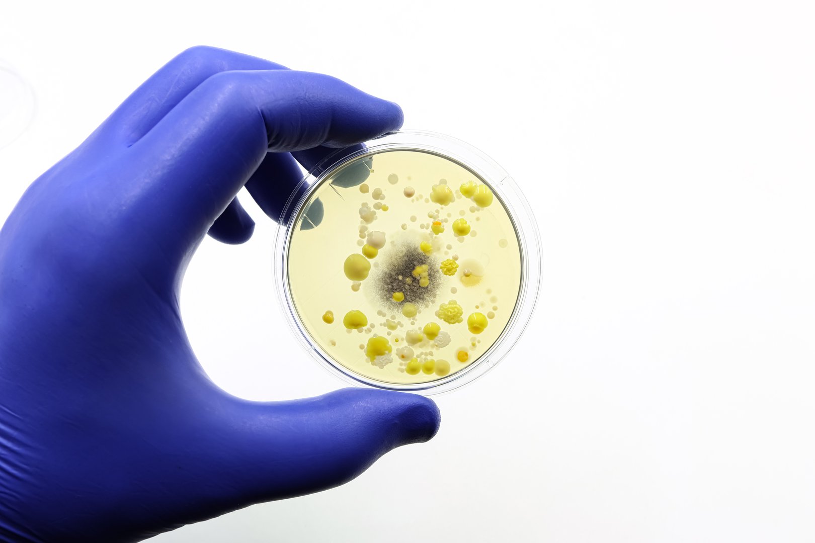 Microbiology. Petri dish with colonies of bacteria and fungi.