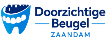 Doorzichtige Beugel Zaandam