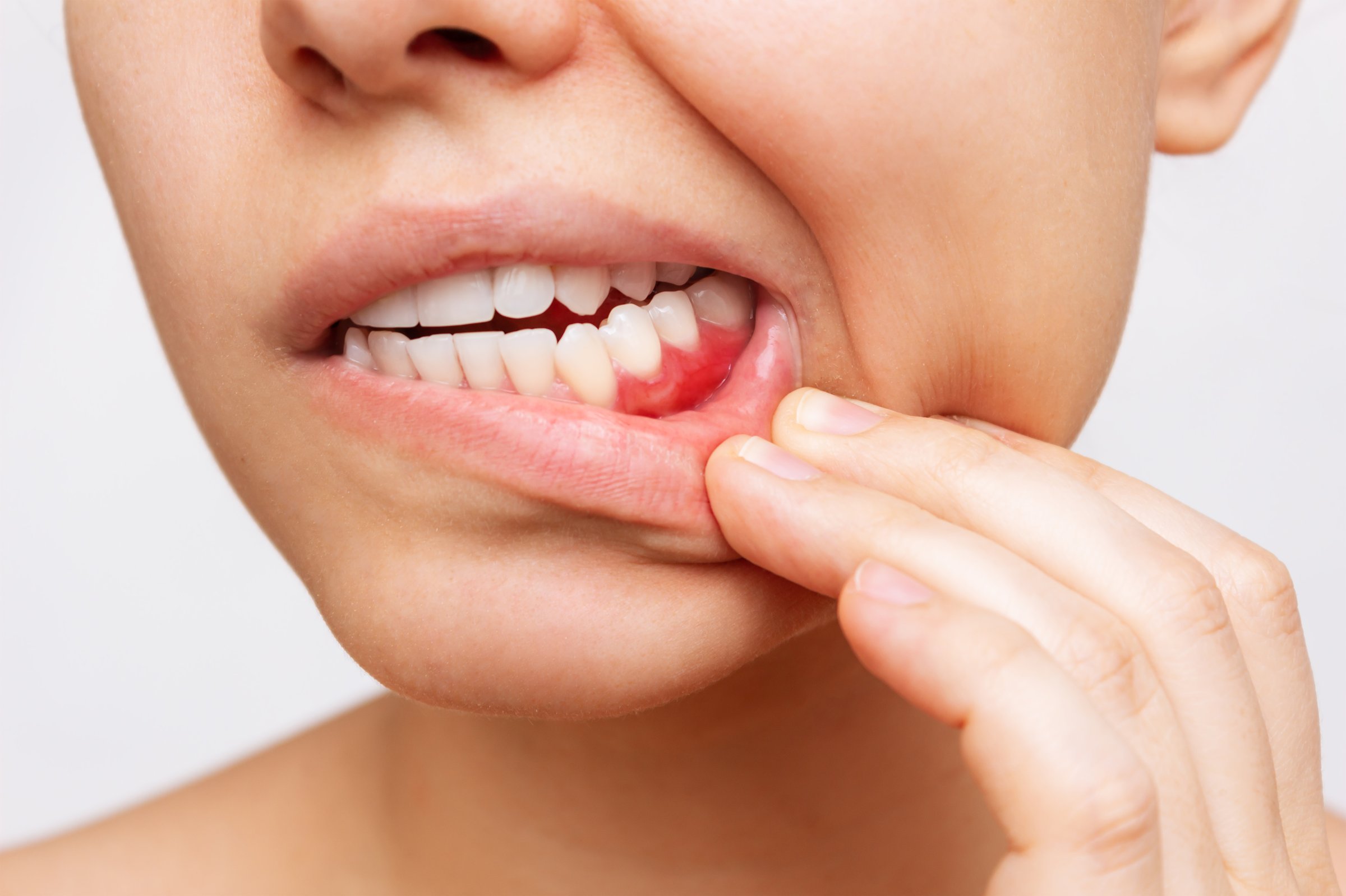 Servicios de Periodoncia