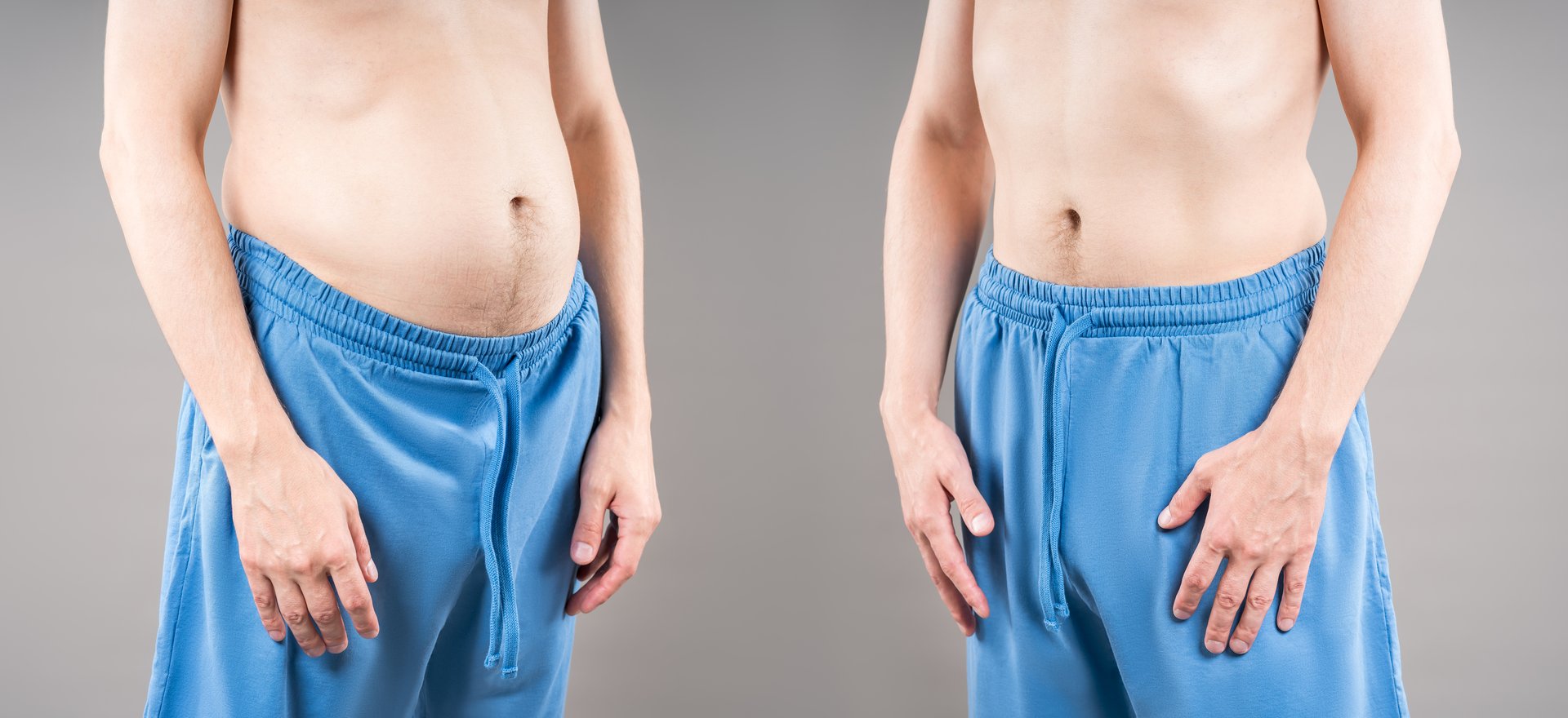 Male body before and after weight loss and dieting, fat man with paunch on grey studio background, plastic surgery concept, image is not body shape retouched
