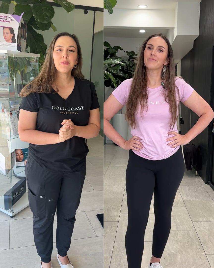 Tirzepatide weight loss transformation