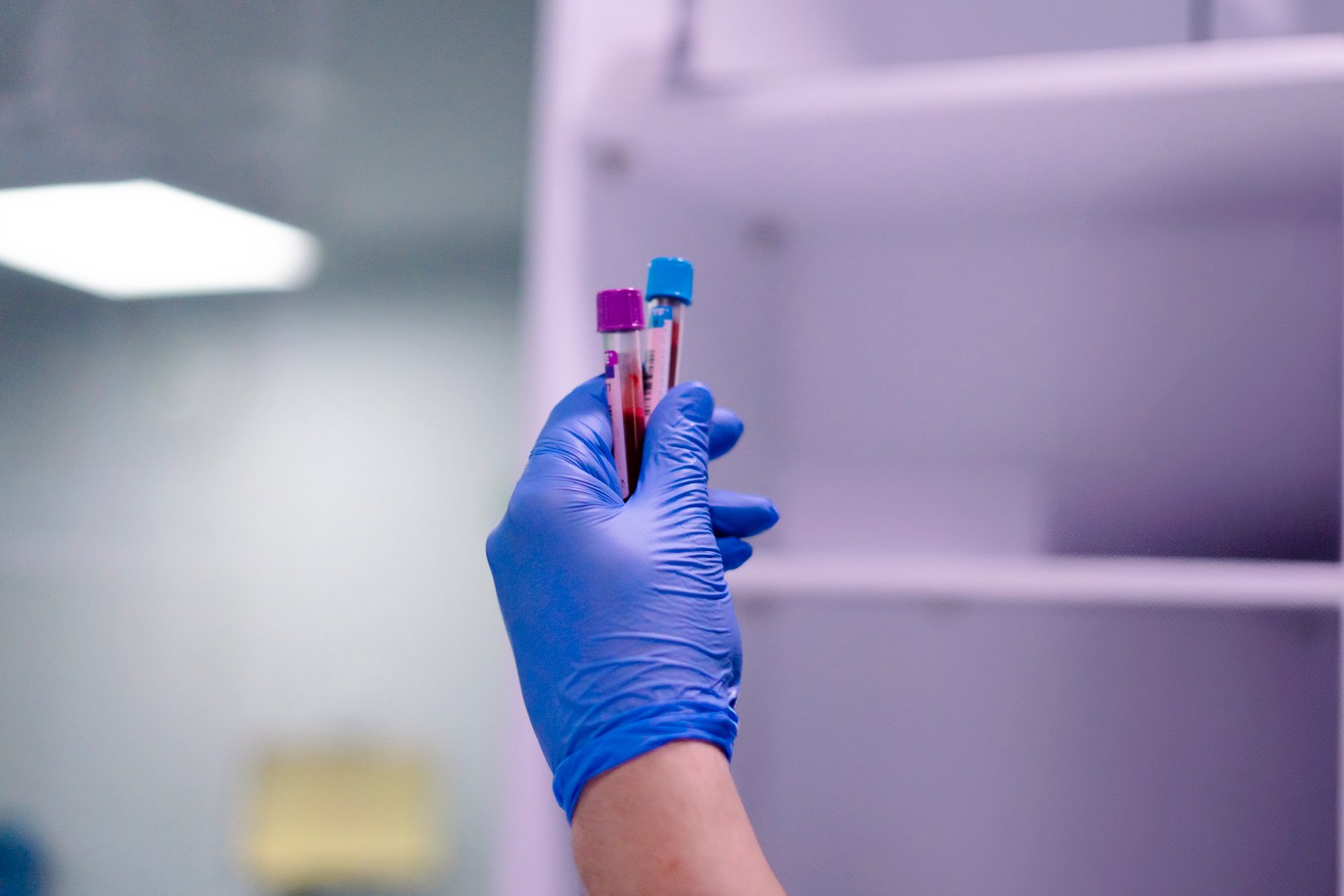 Gloved hand holding blood samples in a laboratory environment, conducting medical research