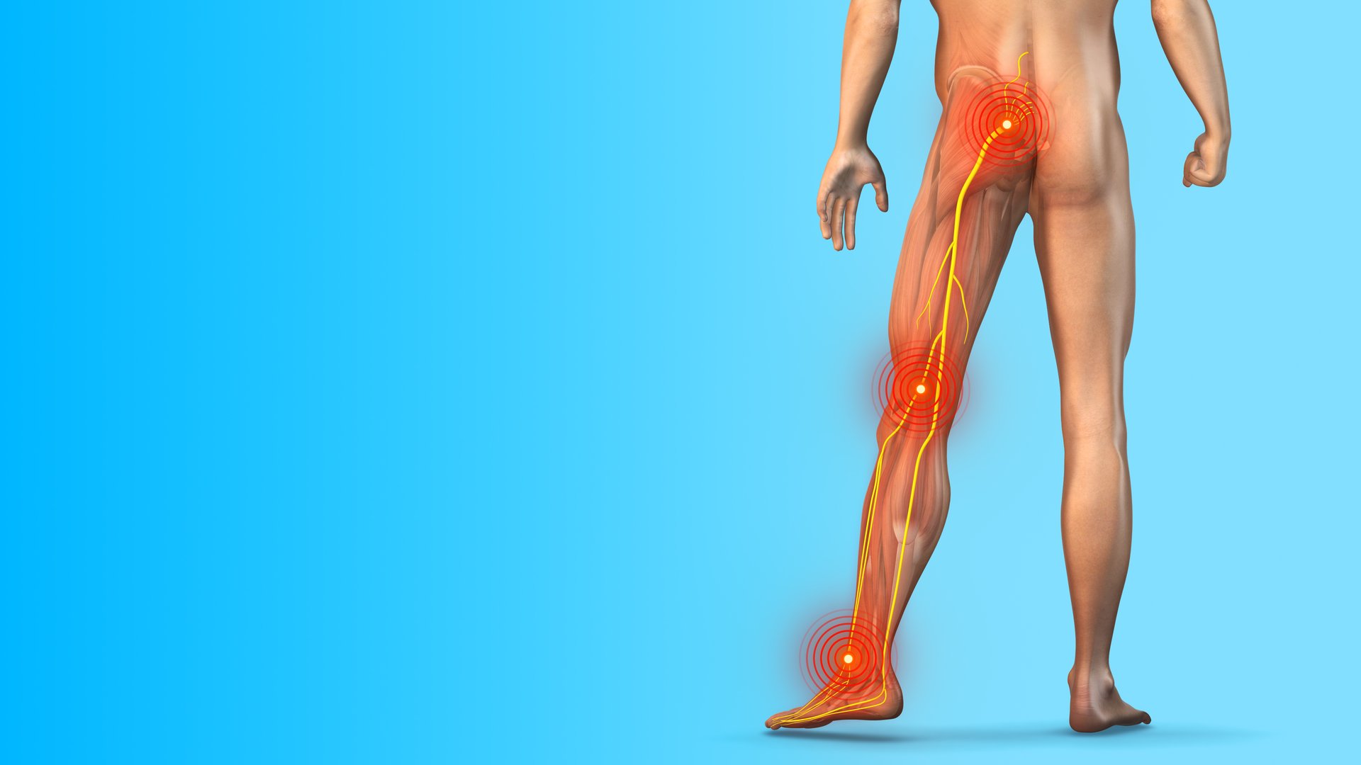 Ankle and plantar fasciitis illustration