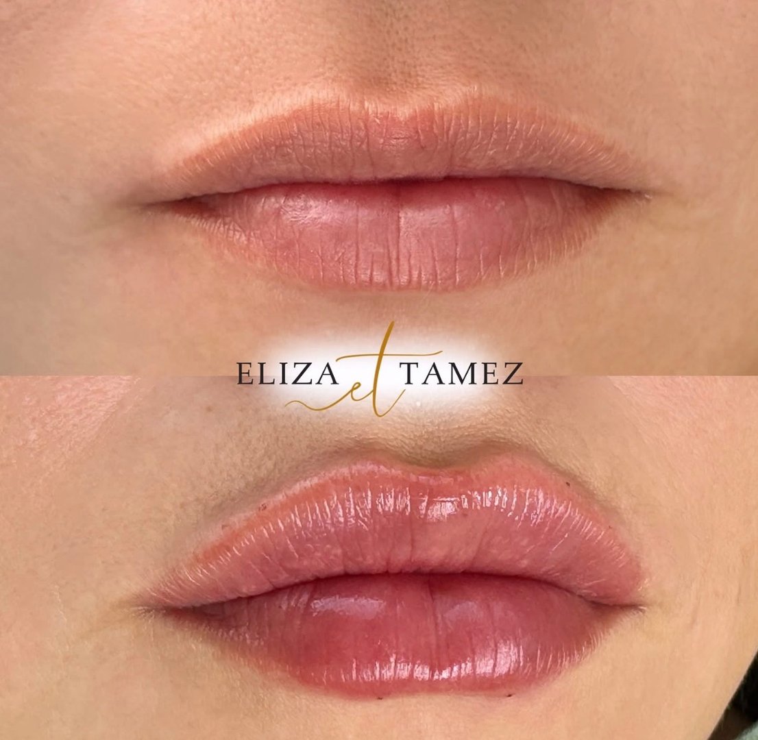 Micropigmentación de labios