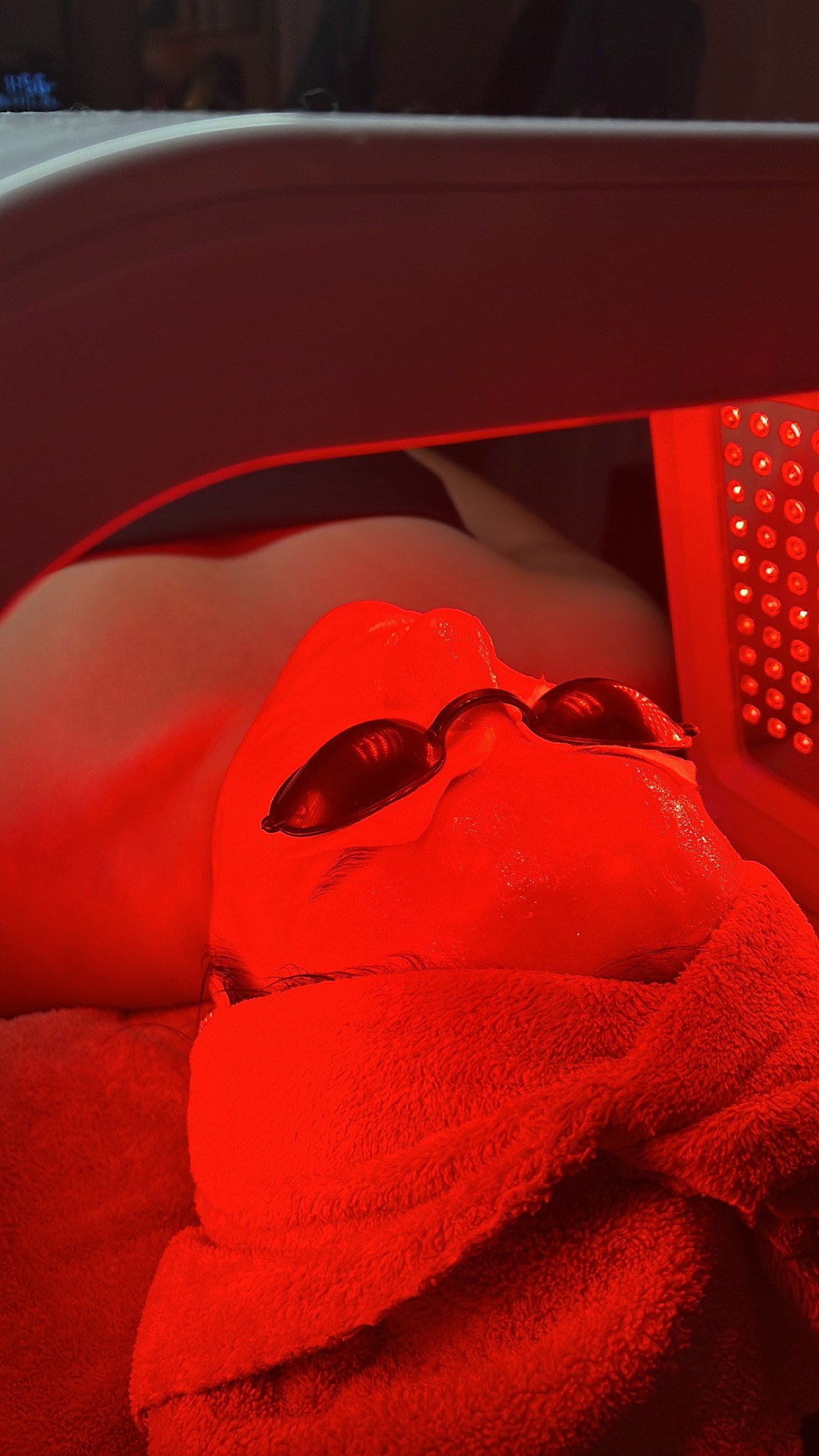 Curing Light Treatment