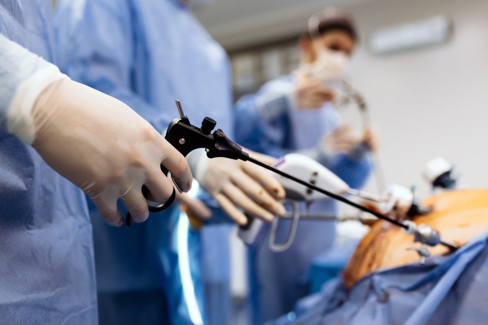 Professional surgeons in the operating room. Instrument for laparoscopic surgery. A surgeon performs laparoscopic gastric surgery in the operating room.