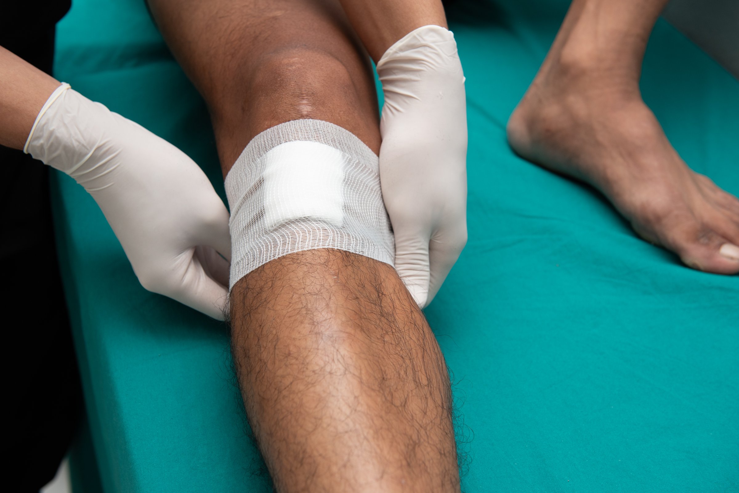 Nurses make leg ulcers in emergency room.
