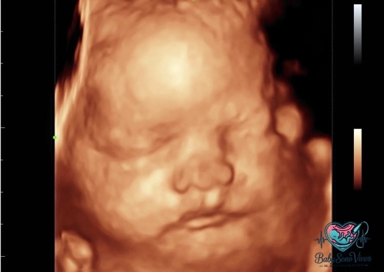 Baby ultrasound session