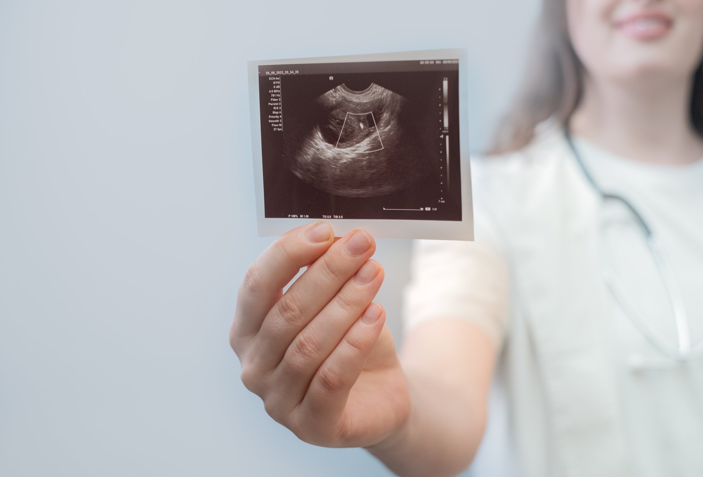 Female obstetrician consults patient, evaluating ultrasound results for effective pregnancy planning.