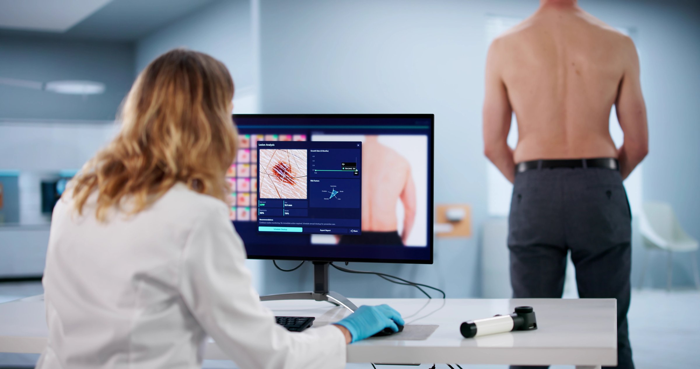 Digital Dermatoscopy: Clinician Screens Patient's Skin Using High-Tech Device
