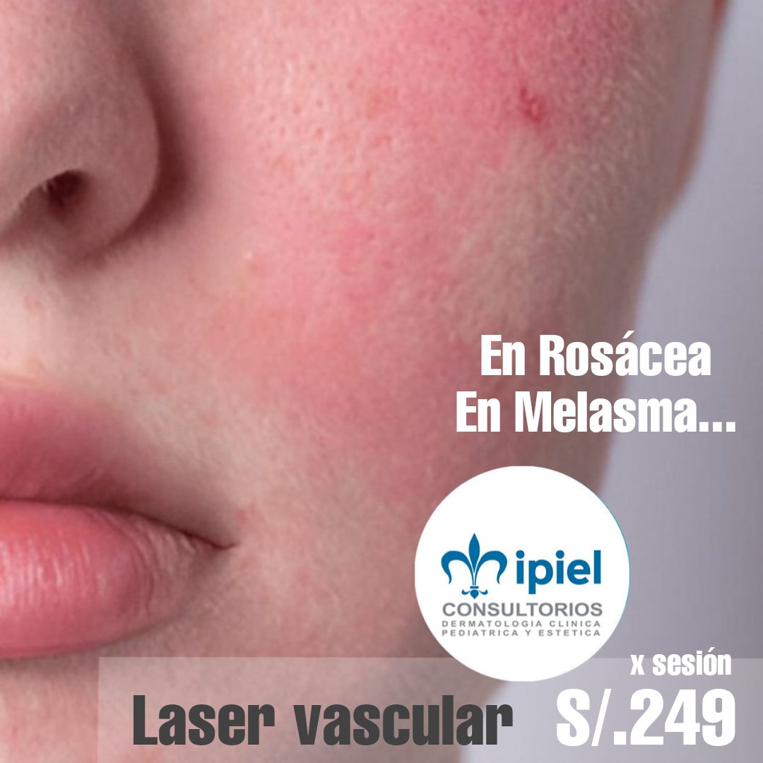 Promoción en dermatología