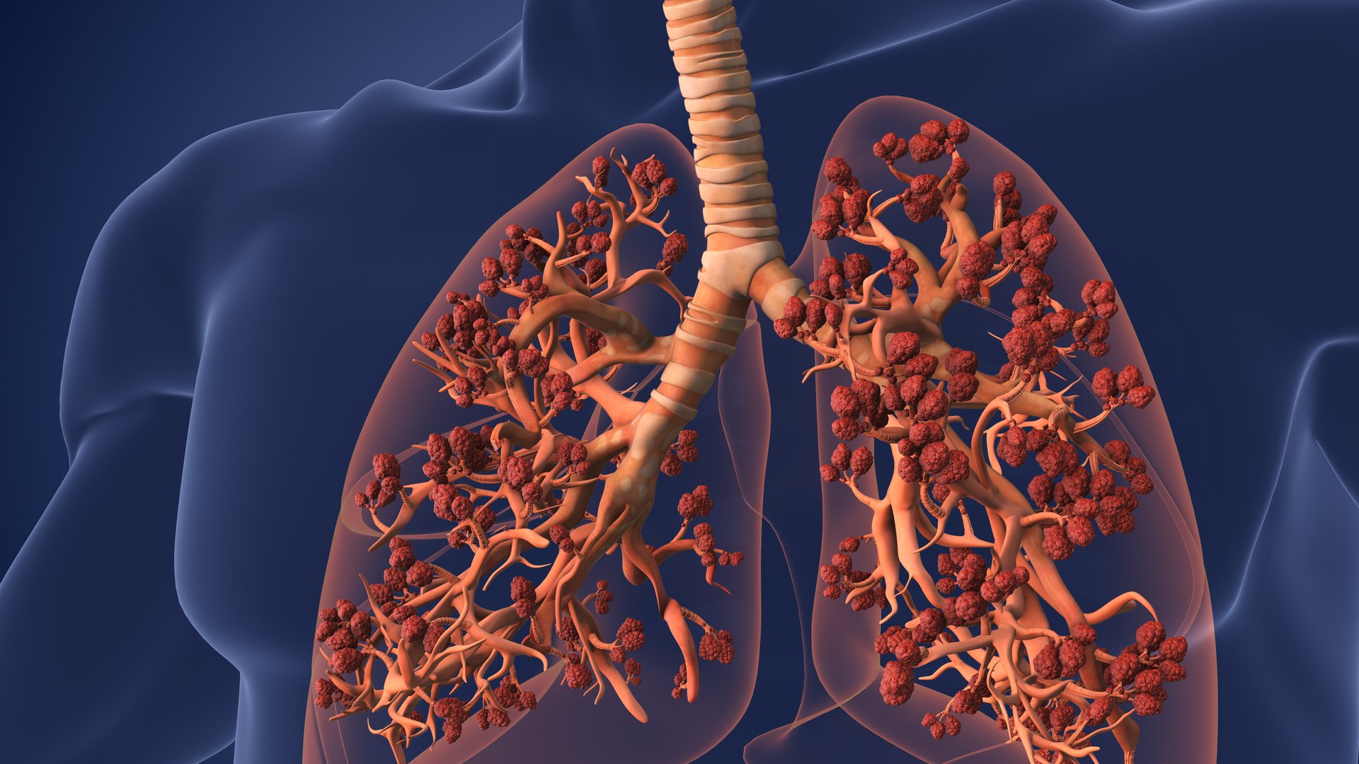 Diagram showing alveoli where lungs and blood exchange oxygen, illustrating how asbestos fibers can become lodged