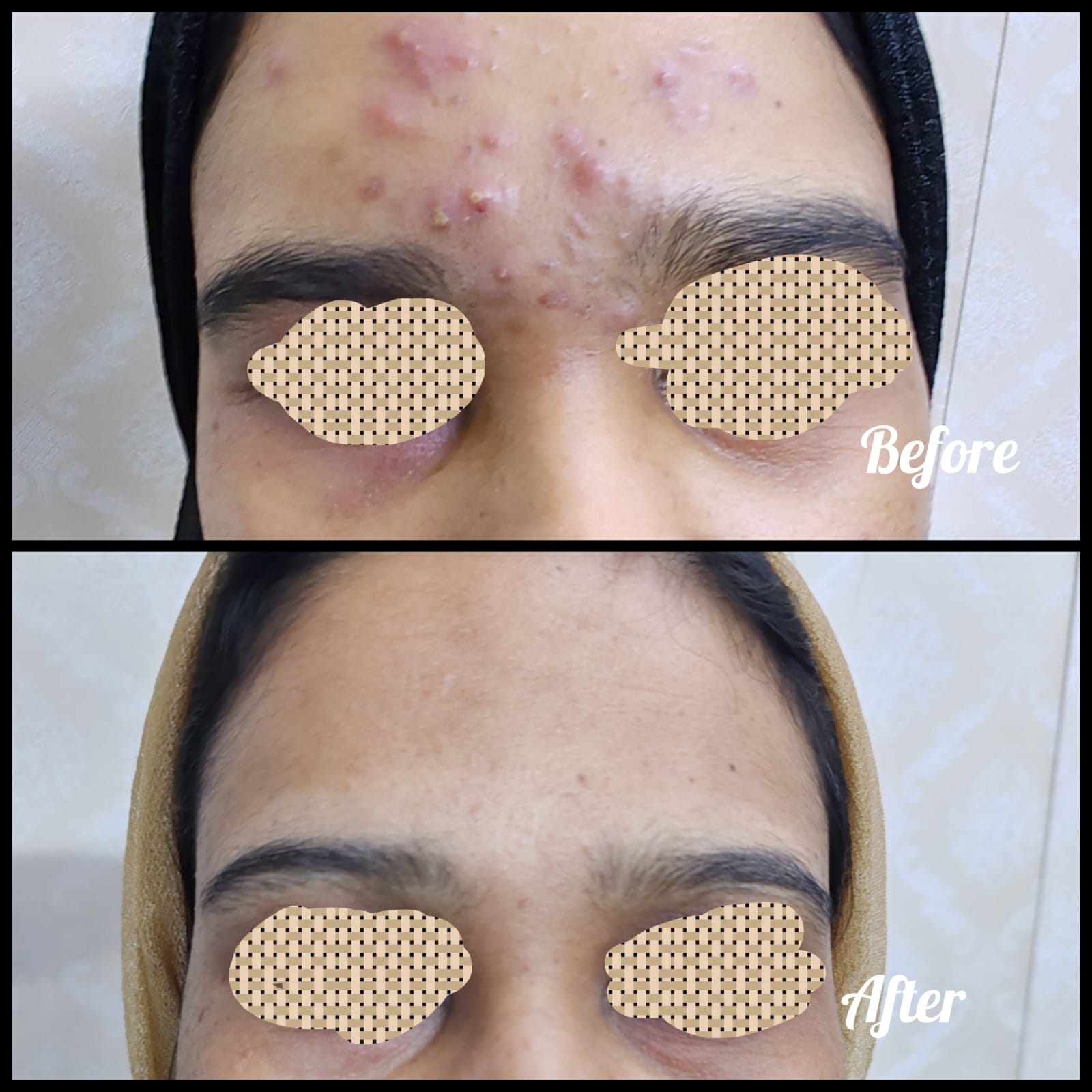 Before and after treatment results