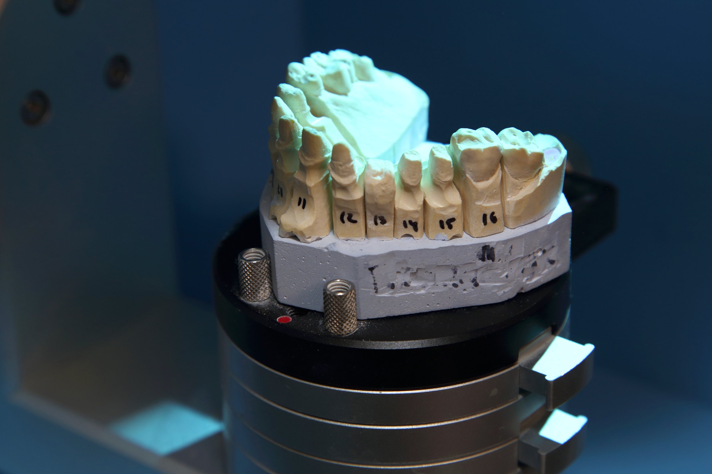 Fabrication of dental crowns and dentures made of ceramic. Scanning of plaster casts of teeth. Fabrication of ceramic dentures in a dental clinic. Ceramic dental crowns for implants.