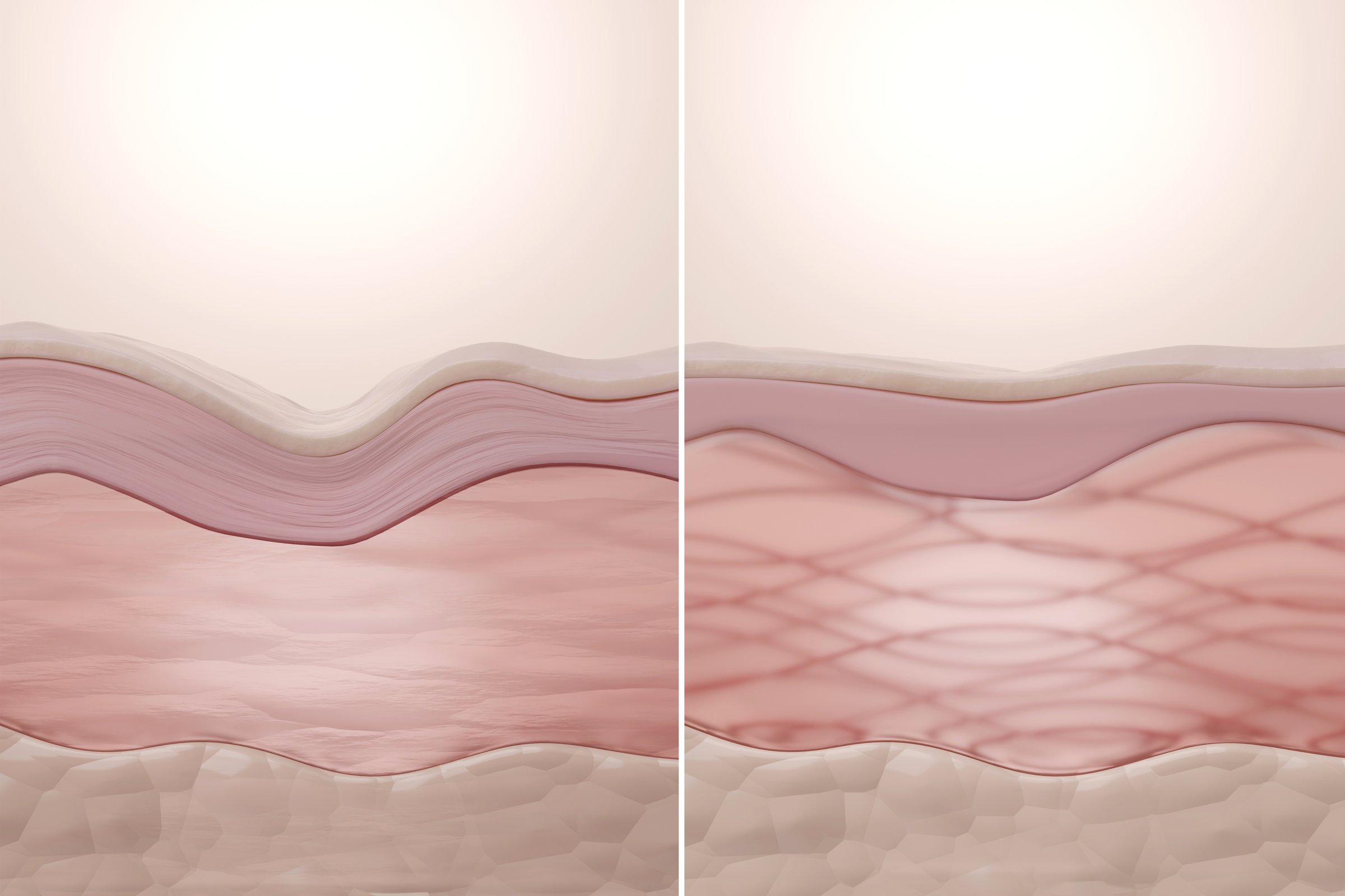 Comparison of aged skin with damaged elastin fibers and youthful skin with strong collagen and elastin network, showing wrinkle reduction.