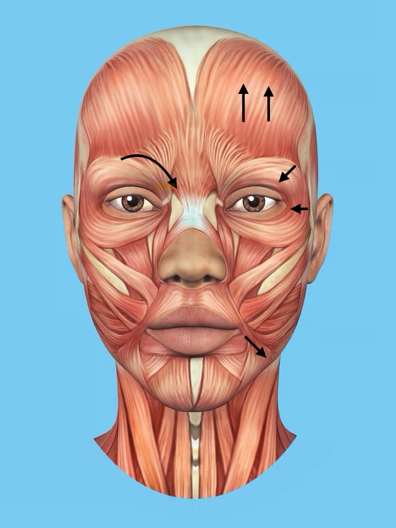Facial anatomy diagram showing muscle structure and injection points for neuromodulator treatments