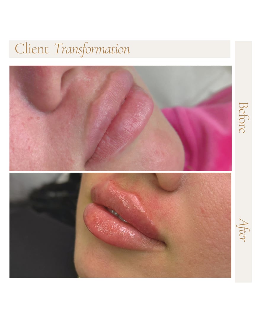 Before and after treatment results