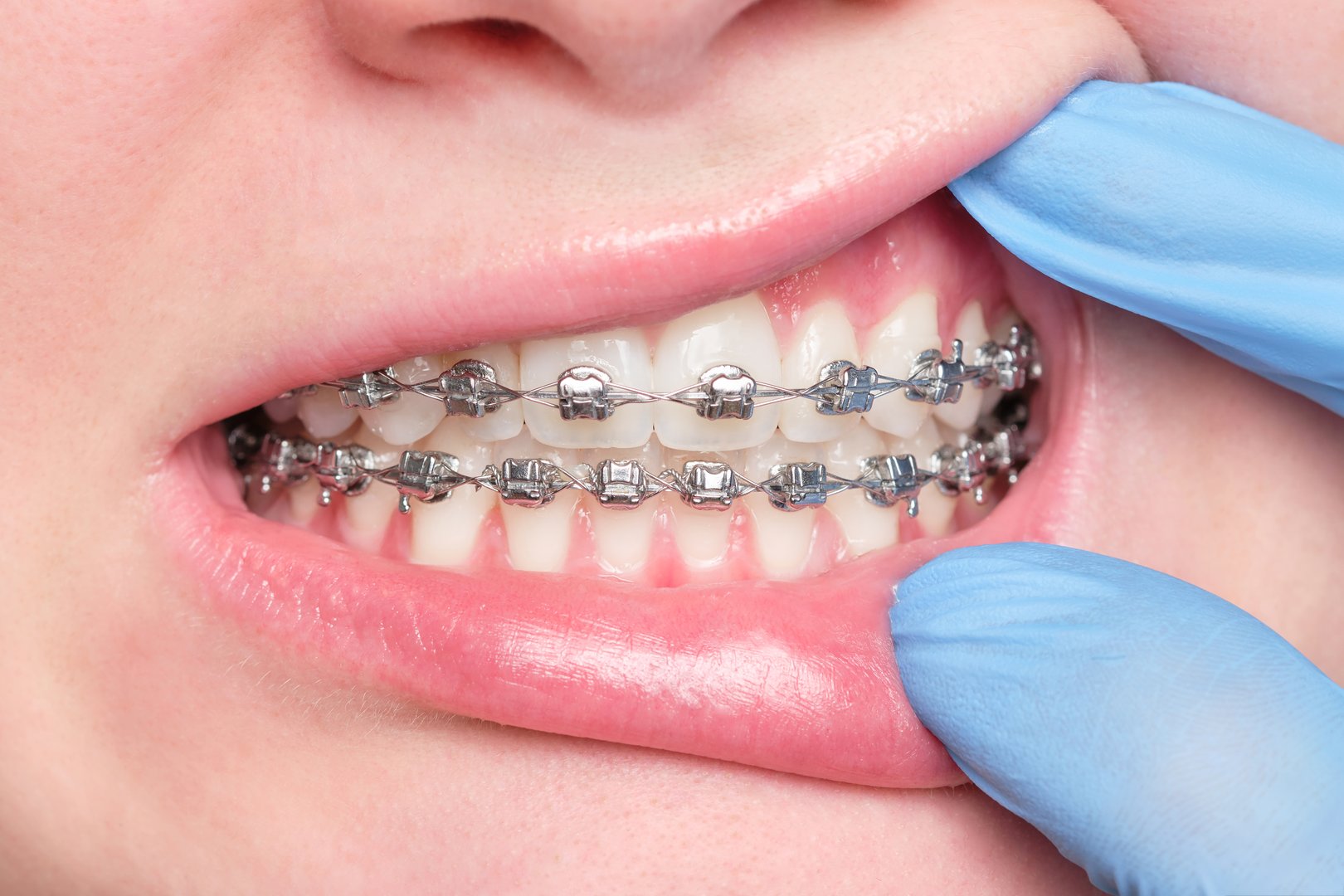 Dentist working on patient's teeth