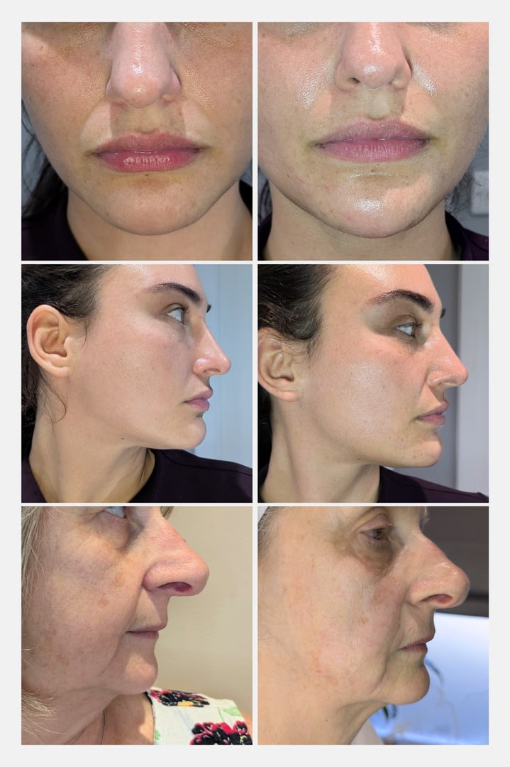 Before and after skin treatment