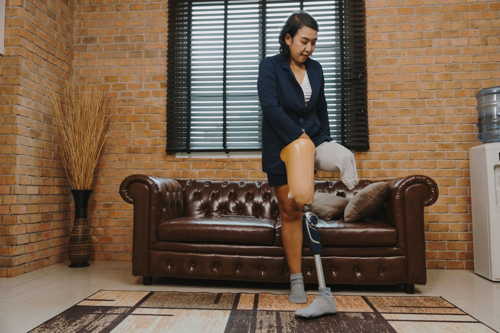 A woman with a leg disability is wearing a prosthetic leg to go to work in an office.