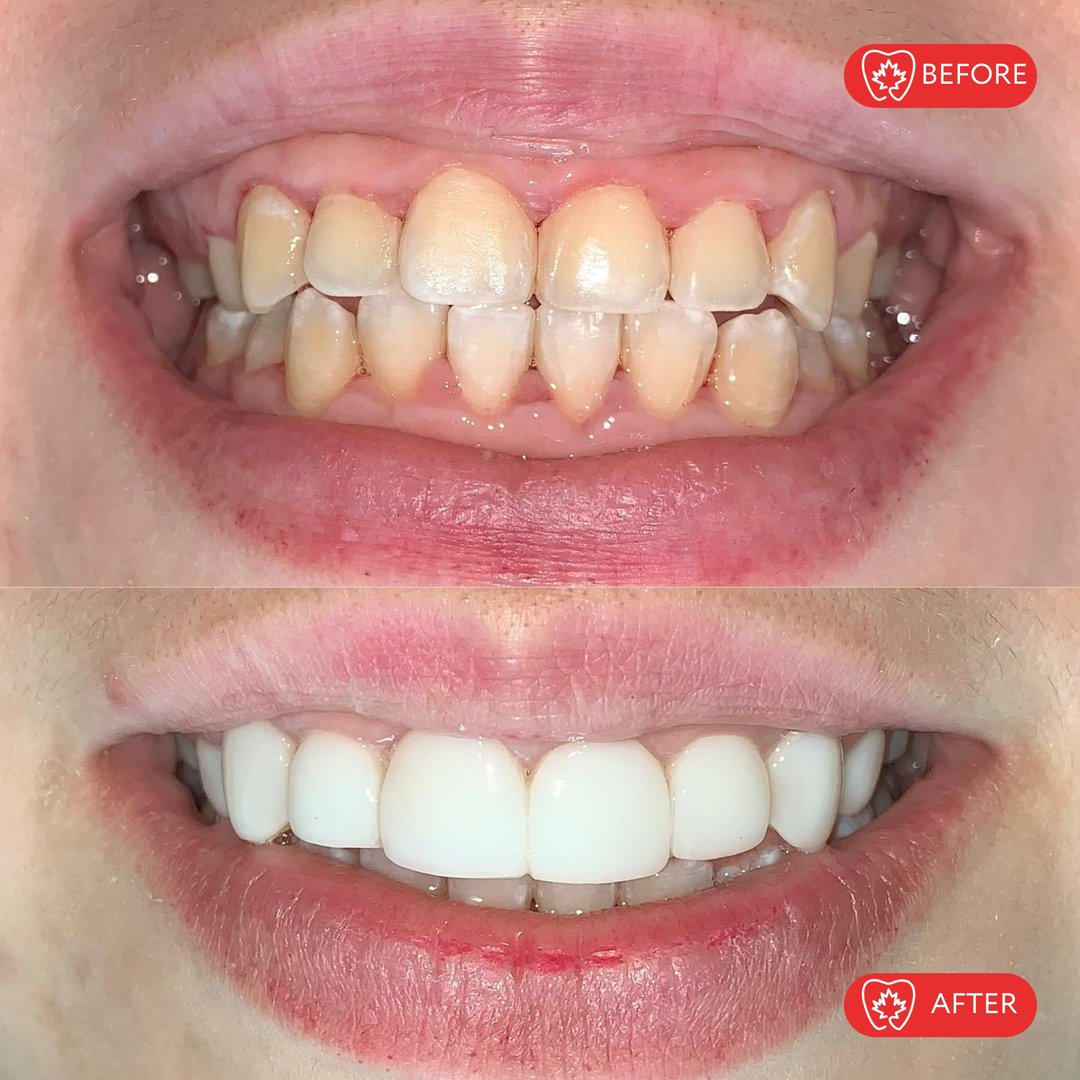 Después del tratamiento