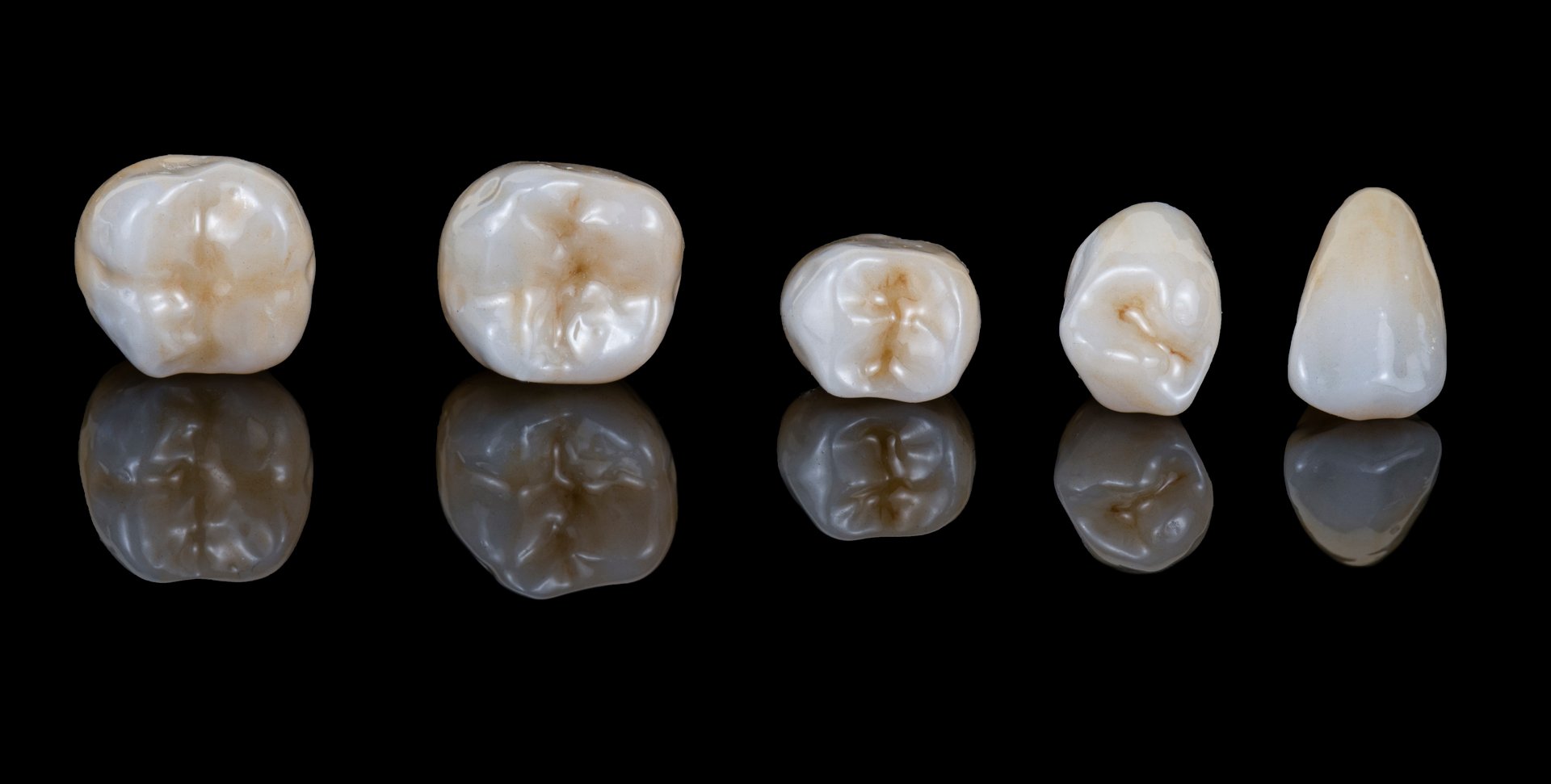 press ceramic crowns and veneers