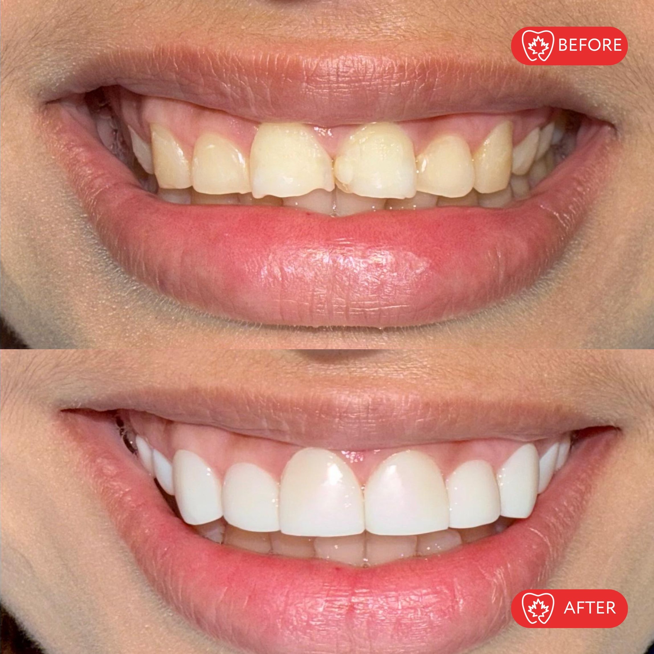 Después del tratamiento