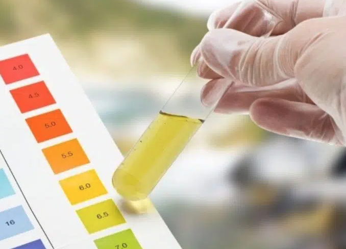 Nguyên nhân sinh lý nước tiểu có mùi