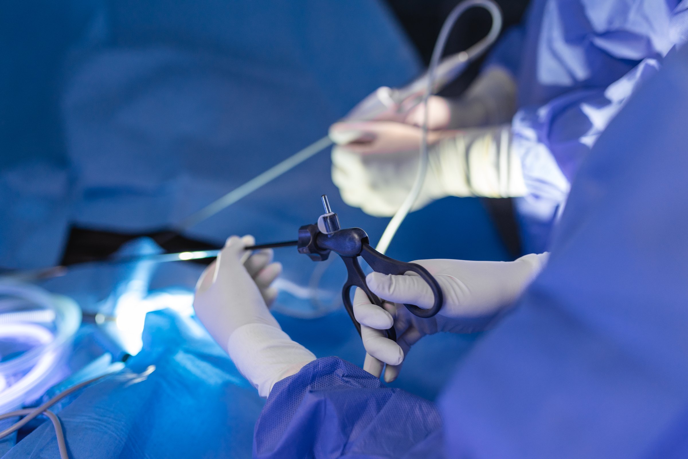 The surgeon's holing the instrument in abdomen of patient. The surgeon's doing laparoscopic surgery in the operating room. Minimally invasive surgery.