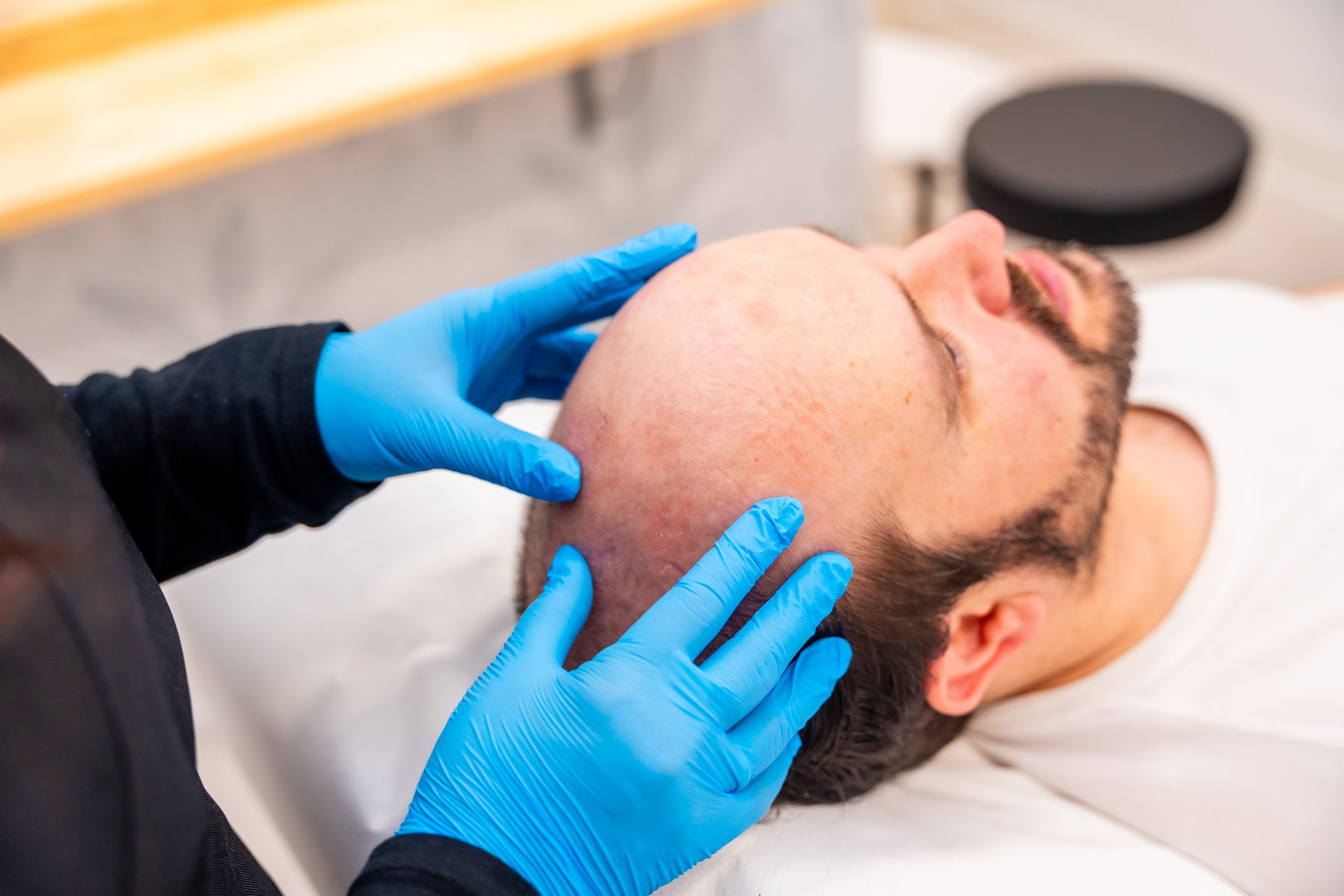 Expertise inspecting the bald man's head before a hair treatment in a beauty clinic