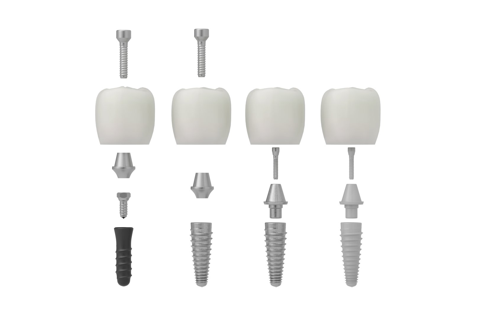 Week-by-week stages of a dental implant procedure explained by a dentist